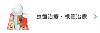 虫歯治療・根管治療